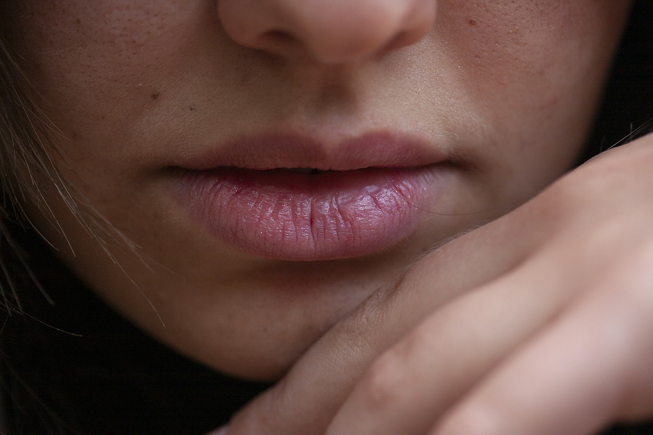 Facts about Canker Sore